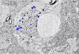 Ultra-thin section through the brain of a zebra